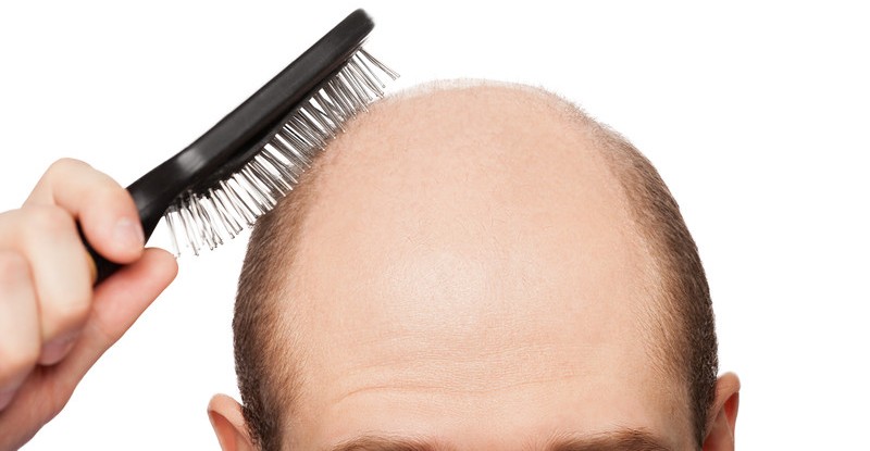 Finasteride info