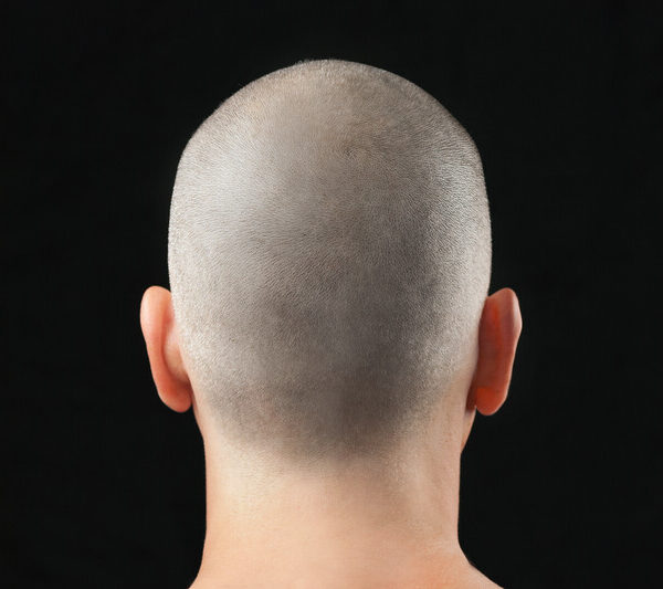 Micro Hair Pigmentation