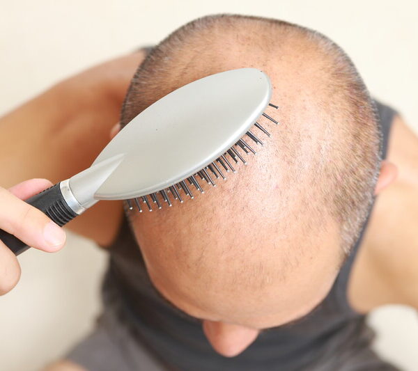 scalp massage brush hair loss