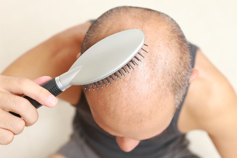 scalp massage brush hair loss
