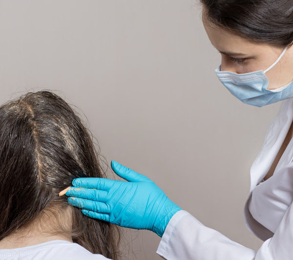 Trichologist minoxidil
